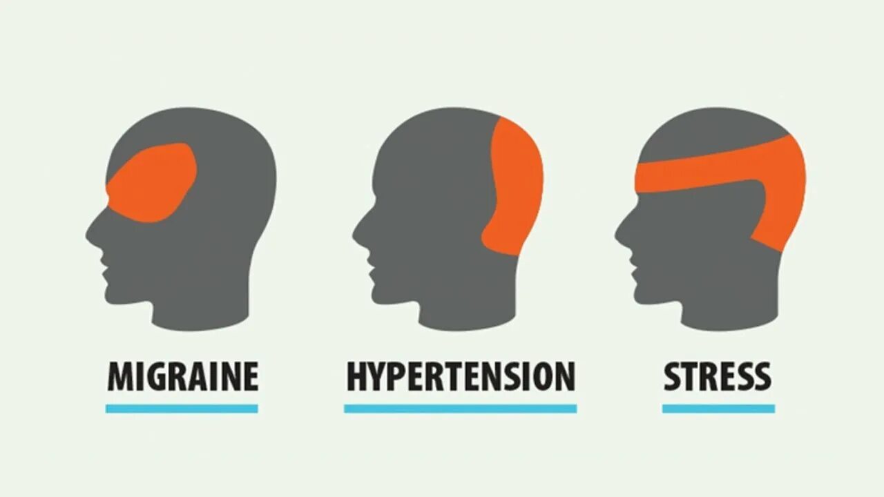 Головная боль. Мигрень гипертония стресс. Боль в голове. Виды головной боли. Включай голова болит