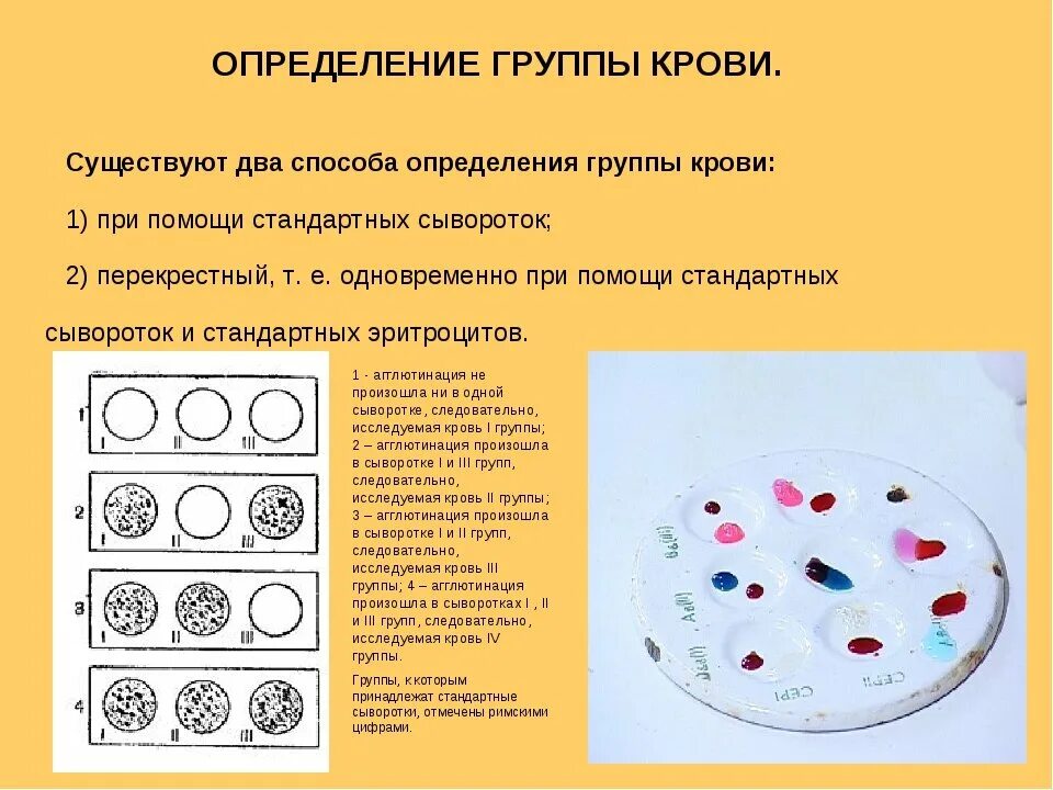 2 группа крови определение. Метод определения крови стандартными сыворотками. Методика определения группы крови. Лабораторные способы определения групп крови. Определение группы крови сыворотками и цоликлонами.