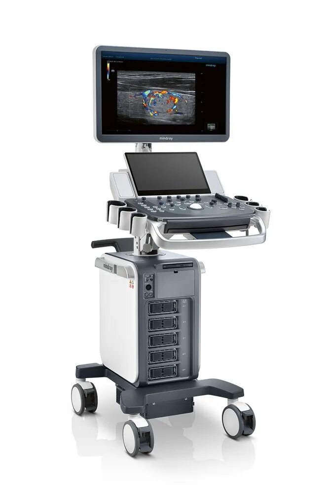 Mindray vetus. Mindray dc-80 pro x-insight. mindray dc-70. миндрей dc 70.