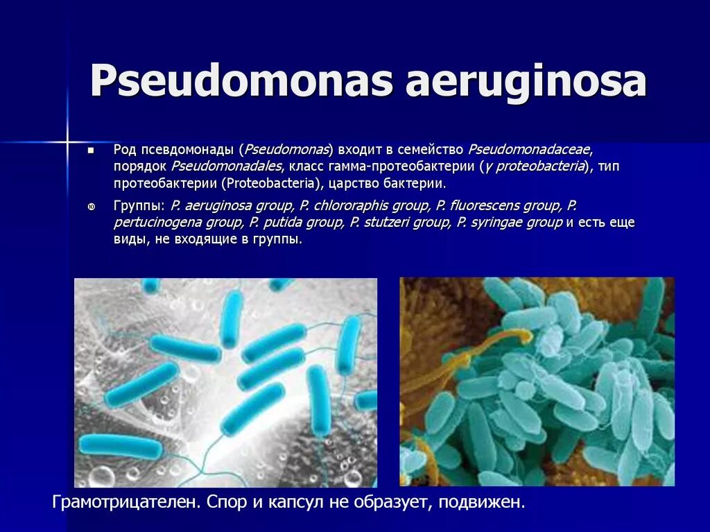Гнойная бактерия. Бактерии псевдомонады. Псевдомонады синегнойная палочка микробиология. • Синегнойная палочка (p. aeruginosa). Синегнойная палочка аэроб.
