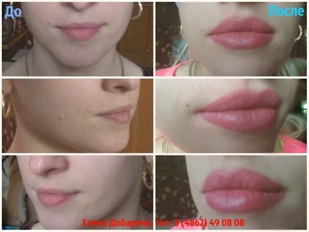 Отек губ после перманентного. Татуаж губ. Тоек после перманентного макияжа губ. Отек после перманентного макияжа губ. Отёк губ после перманентного макияжа.