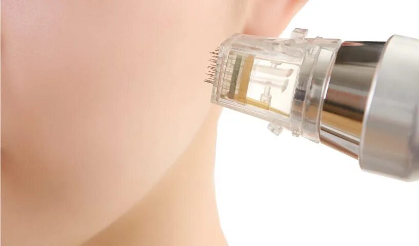 Ellisys plus s. Ellisys plus s аппарат. микроигольчатый rf ellisys plus s. 1. микроигольчатый фракционный рф - лифтинг ellisys plus s. микроигольчатый virtu rf лифтинг.