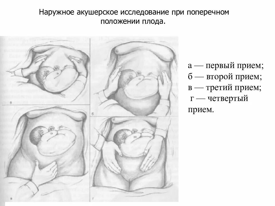 Положение плода в животе. Продольное положение плода при беременности в 30 недель. Продольное положение плода при беременности в 30 недель беременности. Продольное положение плода при беременности в 32 недели. Положение плода продольное предлежание головное.