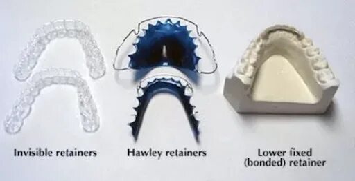 Ретейнеры можно делать мрт. Ретейнер по Хоули. Ретейнер на верхней челюсти.