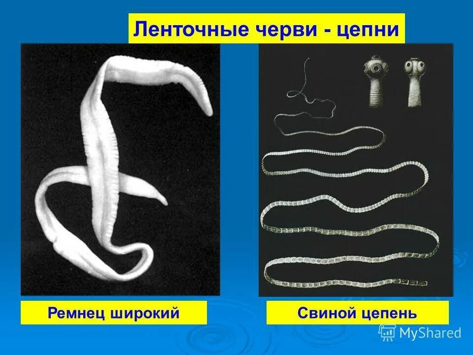 Цепень тип червей. Ленточные черви бычий цепень. Ленточный червь свиной цепень. Ленточные гельминты ремнец. Цестоды, ленточные глисты..