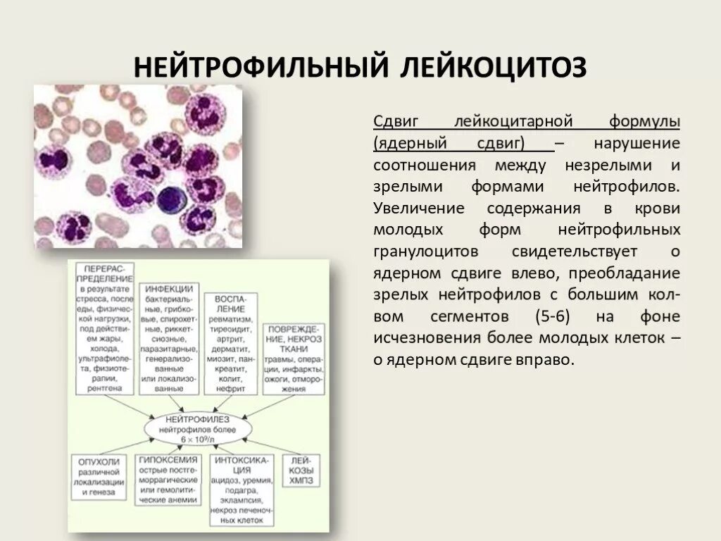 Лейкоцитарный лейкоцитоз. Нейтрофильный лейкоцитоз показатели. Повышение палочкоядерных нейтрофилов сдвиг лейкоцитарной формулы. Схема развития нейтрофильных лейкоцитов. Нейтрофильный лейкоцитоз миелоциты.