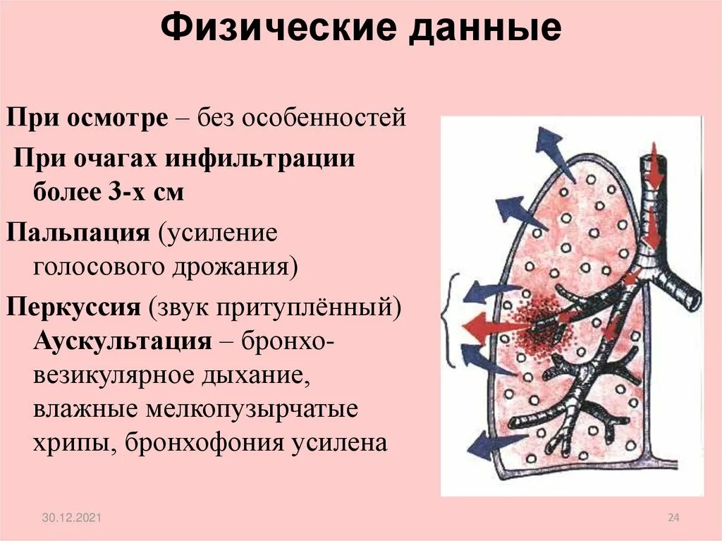 Бронхо везикулярное дыхание. Мелкопузырчатые влажные хрипы возникают в. Мелкопузырчатые хрипы возникают при. Мелкопузырчатые хрипы в легких причины. Хрипы в легких звук