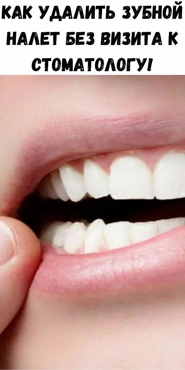 Halitosis Smoke Stain Remover Teeth Whitening Serum Gel Oral Hygiene Dentifrice 