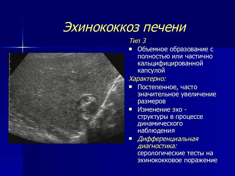 Множественные образования в печени. Эхинококк поражение печени. Очаговые образования в печени на УЗИ. Объемные образования печени. Очаговое поражение печени на УЗИ.