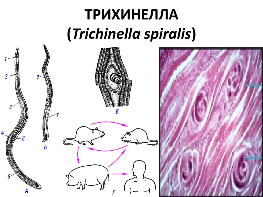 Трихинелла спиральная - Trichinella spiralis. Трихинелла круглые черви. Трихинеллы паразитические черви.