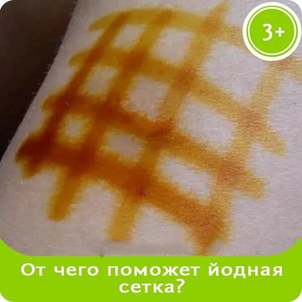 Можно ли йодную сетку при температуре. Можно ли йодную сетку при температуре
