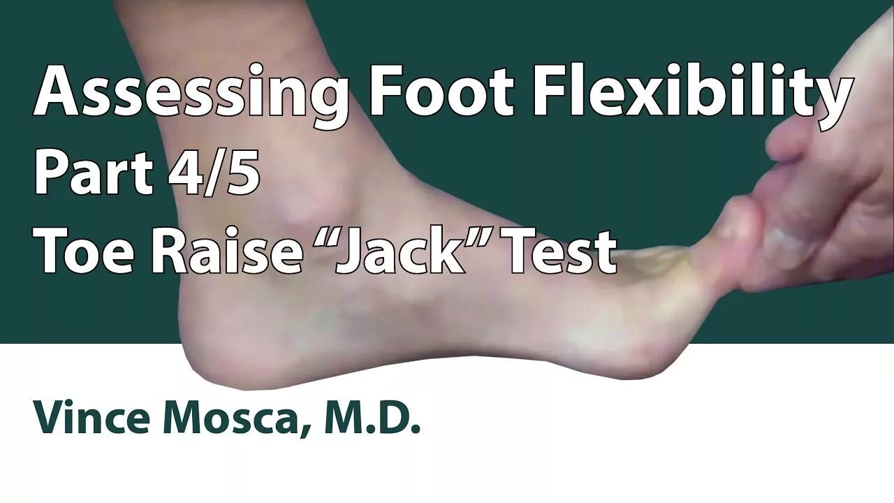 Foot test. Foot test. Диабетическая стопа diabetic foot. Типы стопы. Foot test.