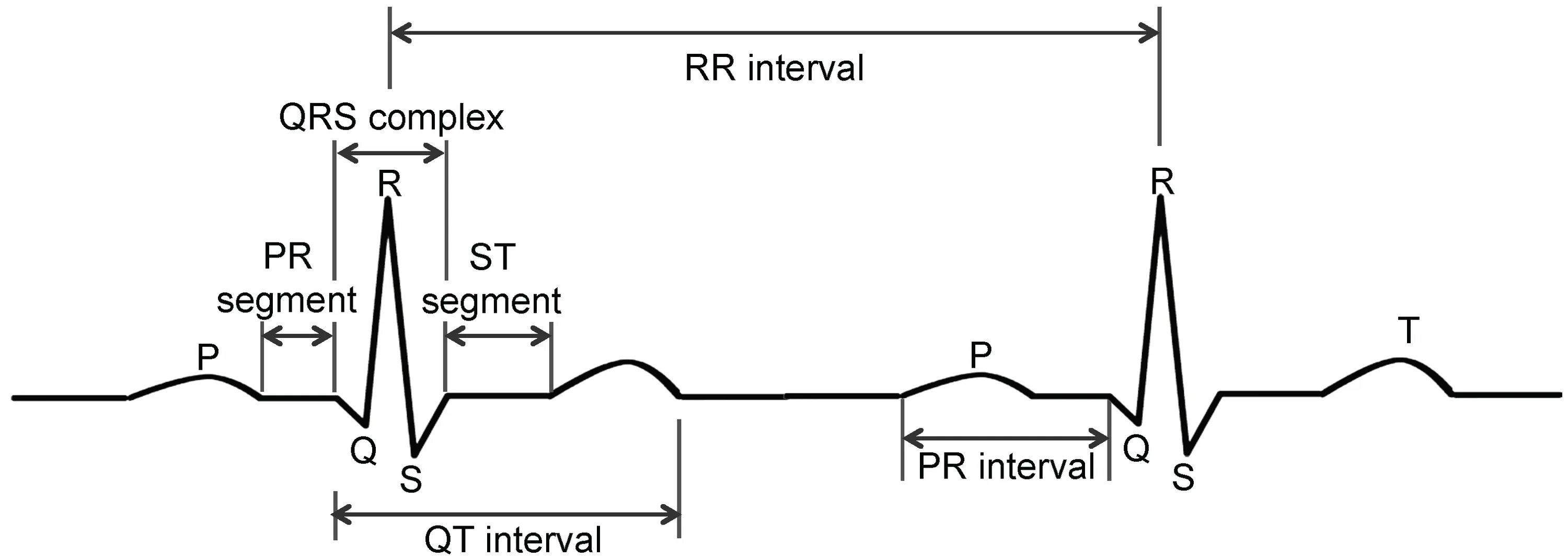 Комплекс QRS норма. Комплекс QRS на ЭКГ. ЭКГ PQRST. Расширение комплекса QRS В v1.