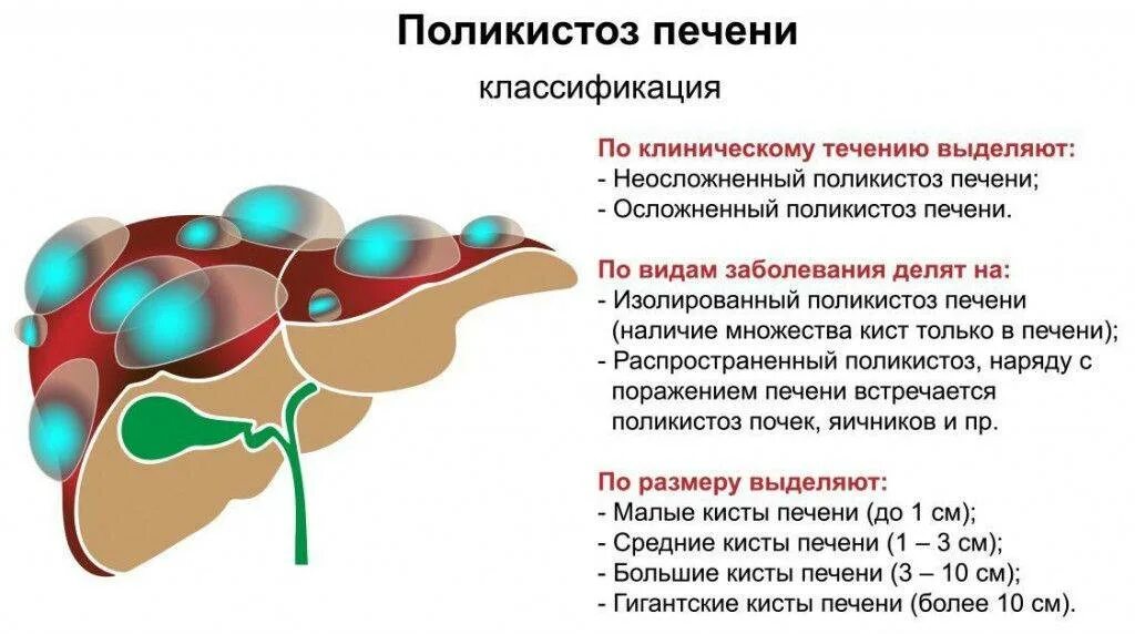 Кисты печени симптомы причины. Кисты печени клинические рекомендации. Поликистоз печени критерии диагноза. Кистозное поражение печени. Поликистоз почек клинические проявления.