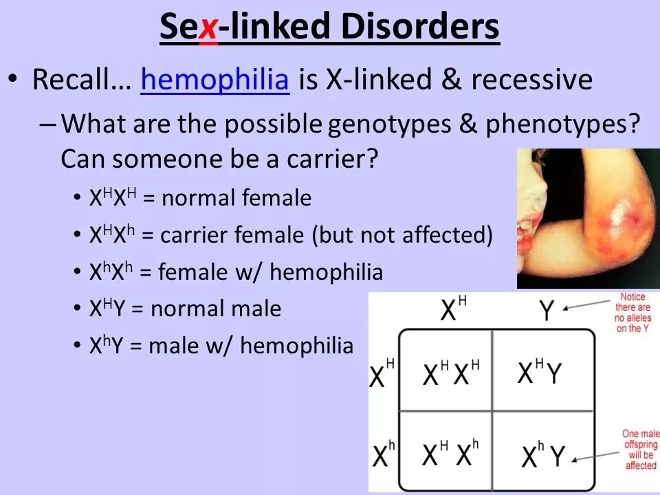 Xhyh xhxh генотип. X linked diseases. Задачи на гемофилию. Genotype MTBDR.