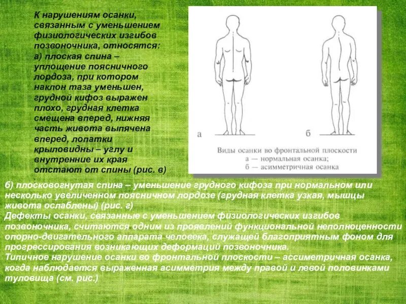 Нарушение изгиба позвоночника. Заболевания связанные с нарушением осанки. Типы нарушения осанки. Тип осанки плоская спина. Осанка нарушение осанки.