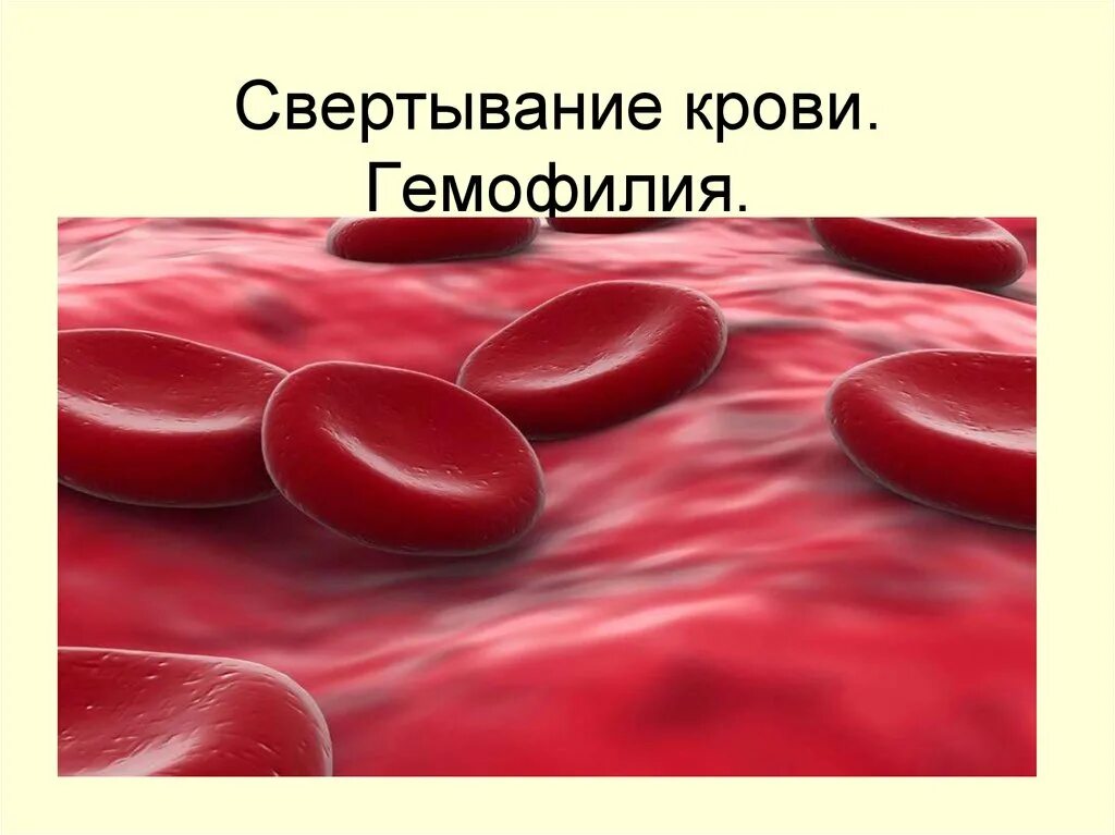 Наследственные заболевания крови. Гемофилия свертывание крови. Свертываемость крови гемофилия.