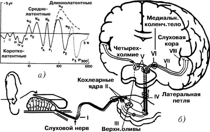 Слуховые стимулы. Исследование слуховых вызванных потенциалов (СВП) ствола мозга. Длиннолатентные слуховые вызванные потенциалы норма. Исследование коротколатентных вызванных потенциалов слуховых. Коротколатентные слуховые вызванные потенциалы (КСВП).