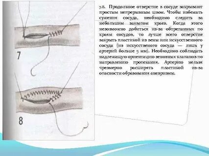 Отверстия в сосуде