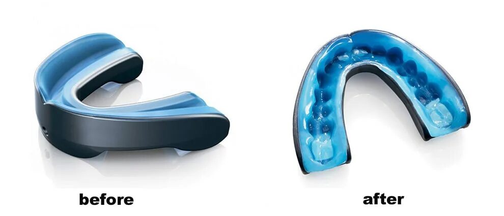 Капа тема. 3 Слойная Капа для бокса. Tsp Капа термопластичная Mouthguard (Navy), Jr. Капа Shock Doctor Nano 3d. Капа для кабеля Epke-0084.