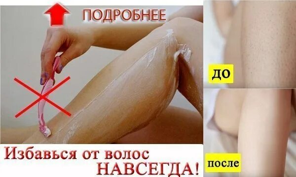 Как избавиться от волос навсегда. Средство от нежелательных волос. избавление от нежелательных волос. методы избавления от нежелательных волос.