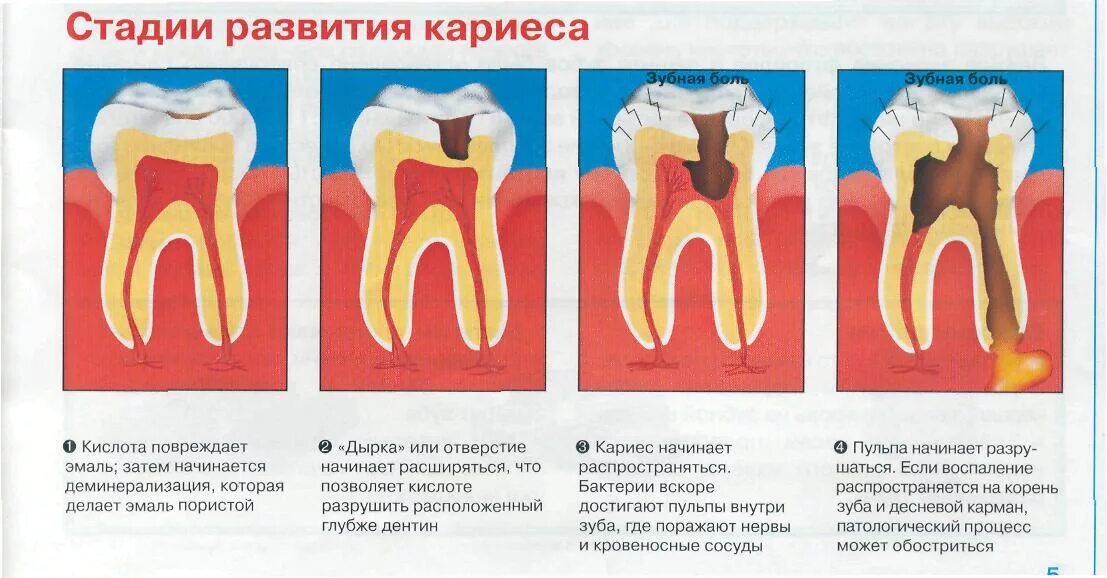 Почему разрушаются зубы как сохранить их здоровыми