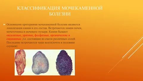 Презентация по теме: Пиелонефрит и мочекаменная болезнь