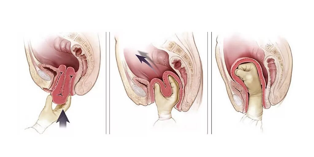 выпад в малом тазу. уттхита триконасана поза треугольника. растягивающий шаг упражнение. упражнение выпады в сторону. выпад в малом тазу.