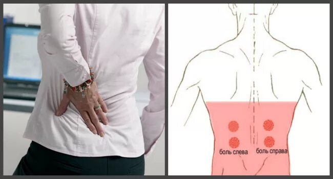 Поясница левая часть. Боль внизу спины. Болит поясница внизу справа.