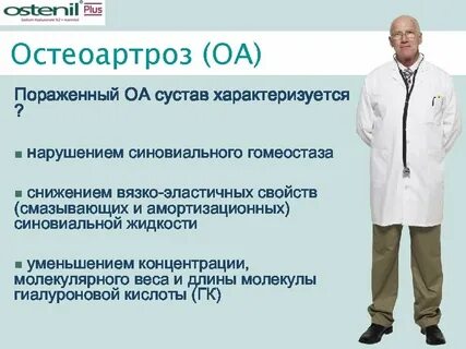 Остеоартроз врач