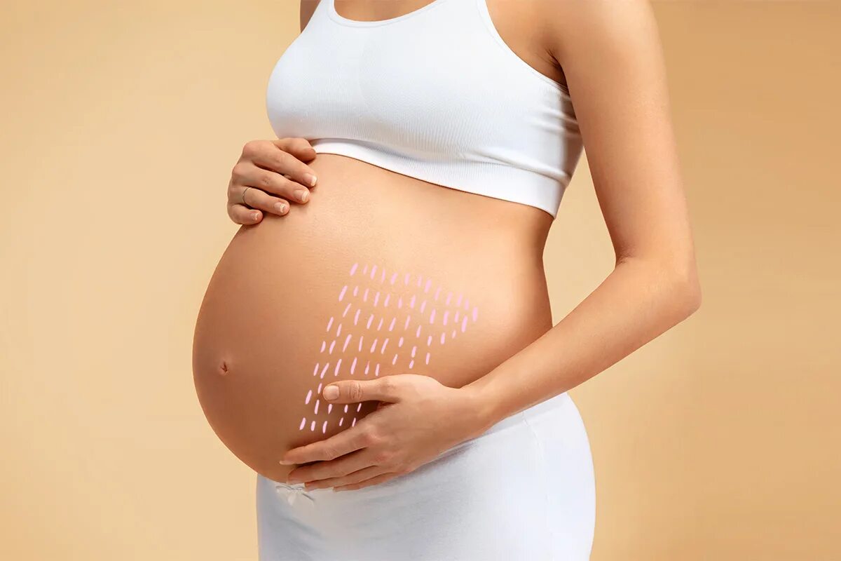 После беременности. Растяжки беременность. Беременная женщина растяжки. Растяжка для беременных 3 триместр. Бульканье в беременном животе.