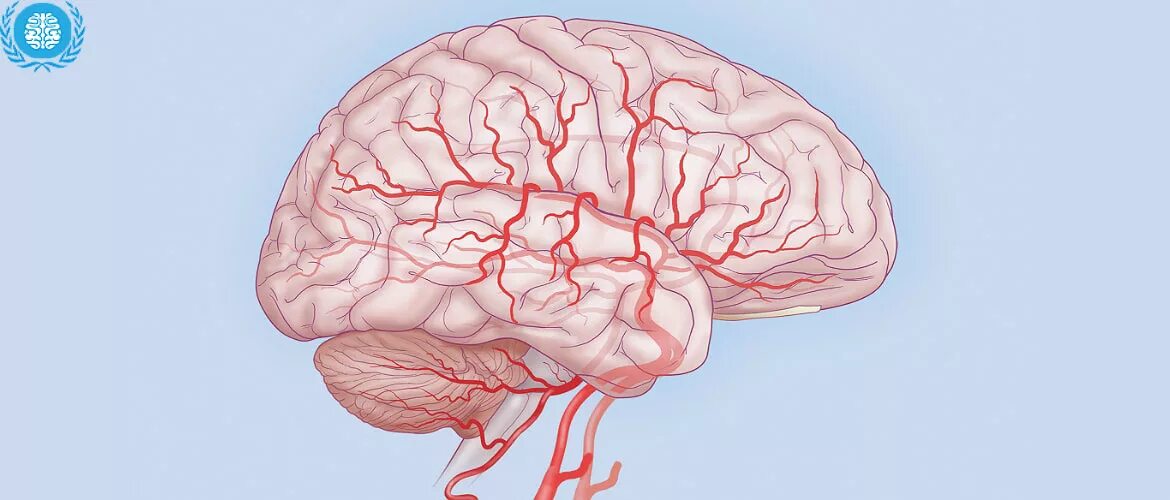 Нервные сосуды головного мозга. Нейросифилис мозг патология. Энцефалопатия поражение головного мозга. Мозг поражённый энцефалопатией.