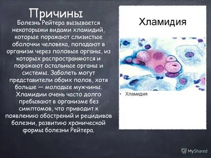 Откуда у мужчин инфекция