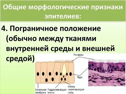 Выраженное изменение клеток плоского эпителия