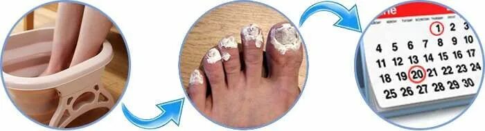 бакторецил