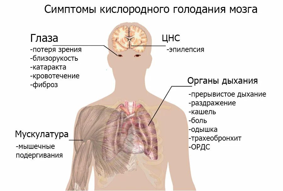 Кислородное голодание мозга симптомы у взрослых. Кислородное голодание симптомы у взрослых. Признаки гипоксии головного мозга. Безкислороднте голодание. Головокружение от голода