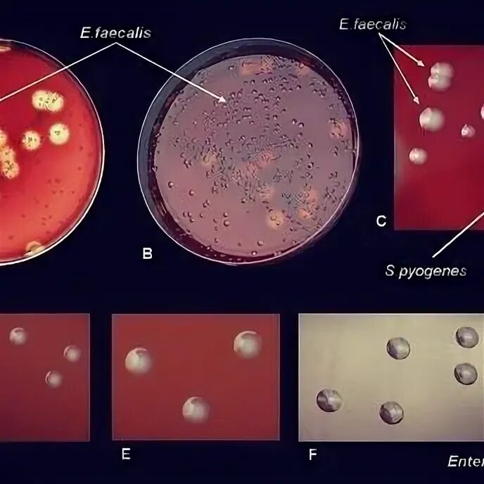 Enterococcus faecalis 10 в 6