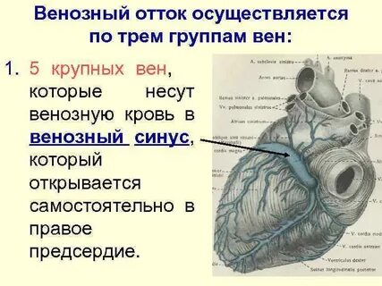 Синусы сердца