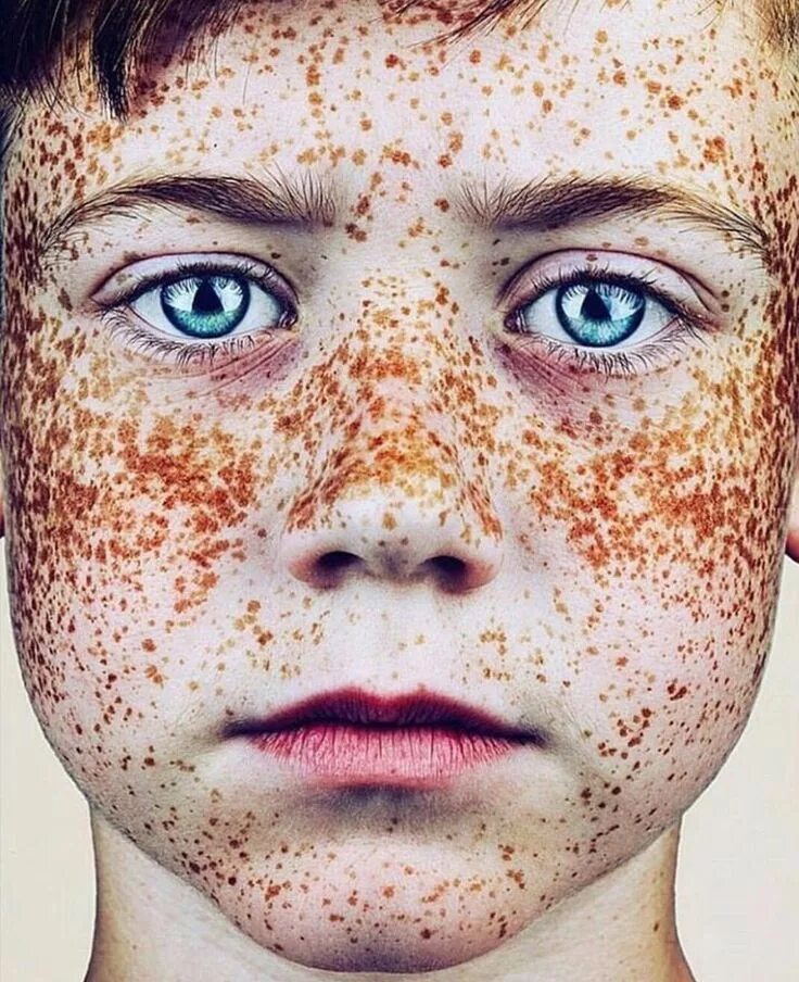 Freckles перевод. Веснушки на лице. Конопушки и веснушки. Рыжие с конопушками.