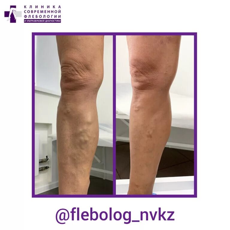 флебология новокузнецк дружбы 3. тюмень ул одесская 48 центр флебологии. флебология новокузнецк дружбы 3. флебология новокузнецк дружбы 3. флебология новокузнецк дружбы 3.