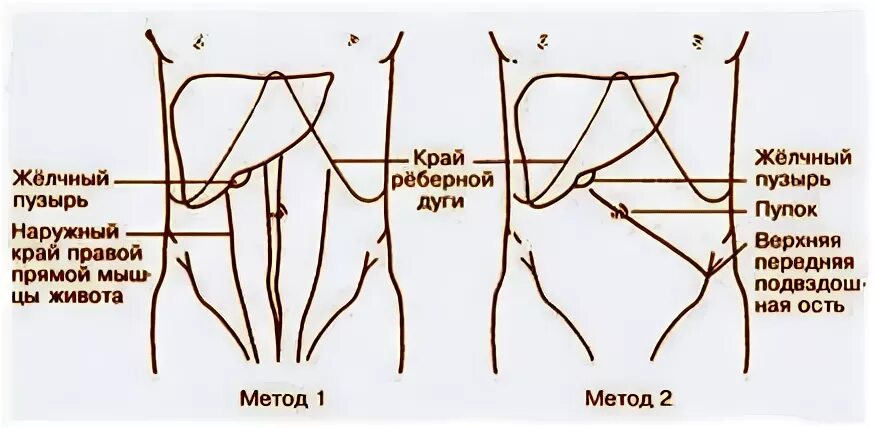 Печень у края реберной. Точка проекции желчного пузыря. Проекция желчного пузыря на переднюю брюшную стенку. Точка проекции желчного пузыря на переднюю брюшную. Пальпация печени точки желчного пузыря.