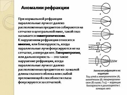 Астигматизм тест нмо с ответами по утвержденным