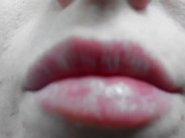 После поцелуя появляется. Красное пятнышко на губе.