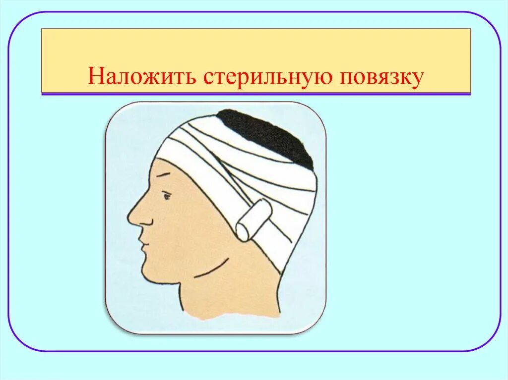 Повязка накладывается при повреждении затылка. Десмургия повязка чепец. Повязка на голову при травме. Наложение асептической повязки на голову. Наложение повязки при травме головы.