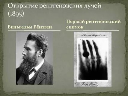 Открытие рентгена