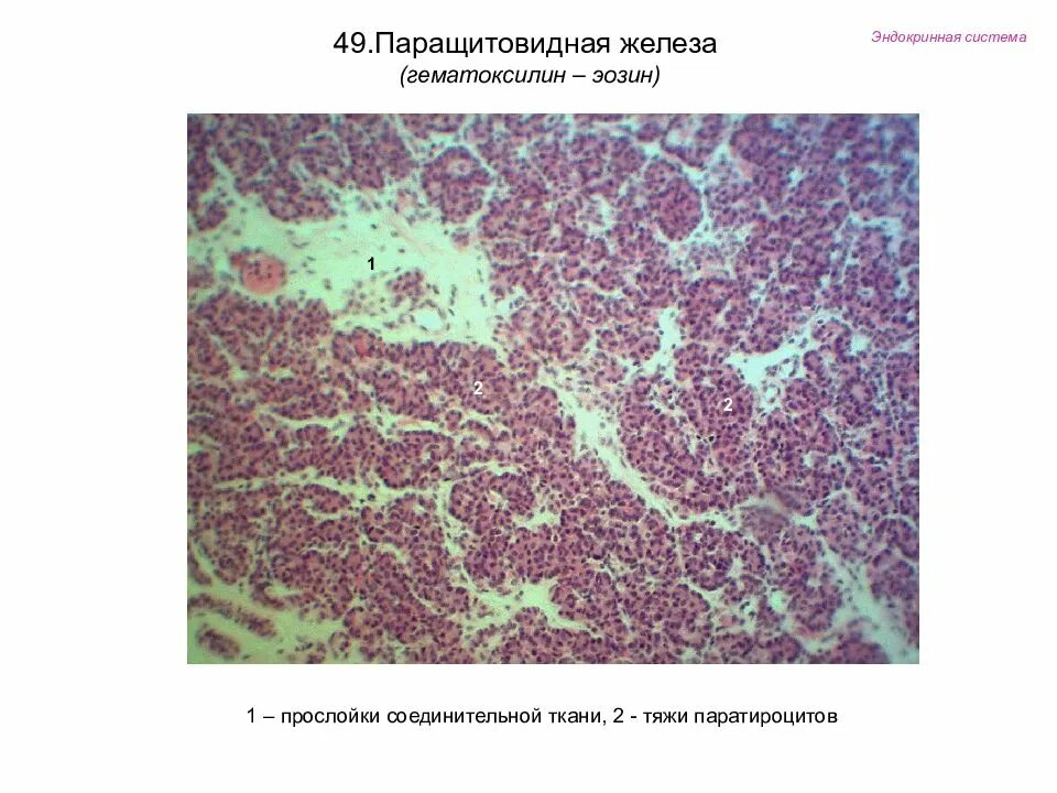 Паращитовидная гистология. Паращитовидная железа гистология. околощитовидная железа гистология. строение паращитовидной железы гистология. паращитовидная железа гематоксилин эозин.