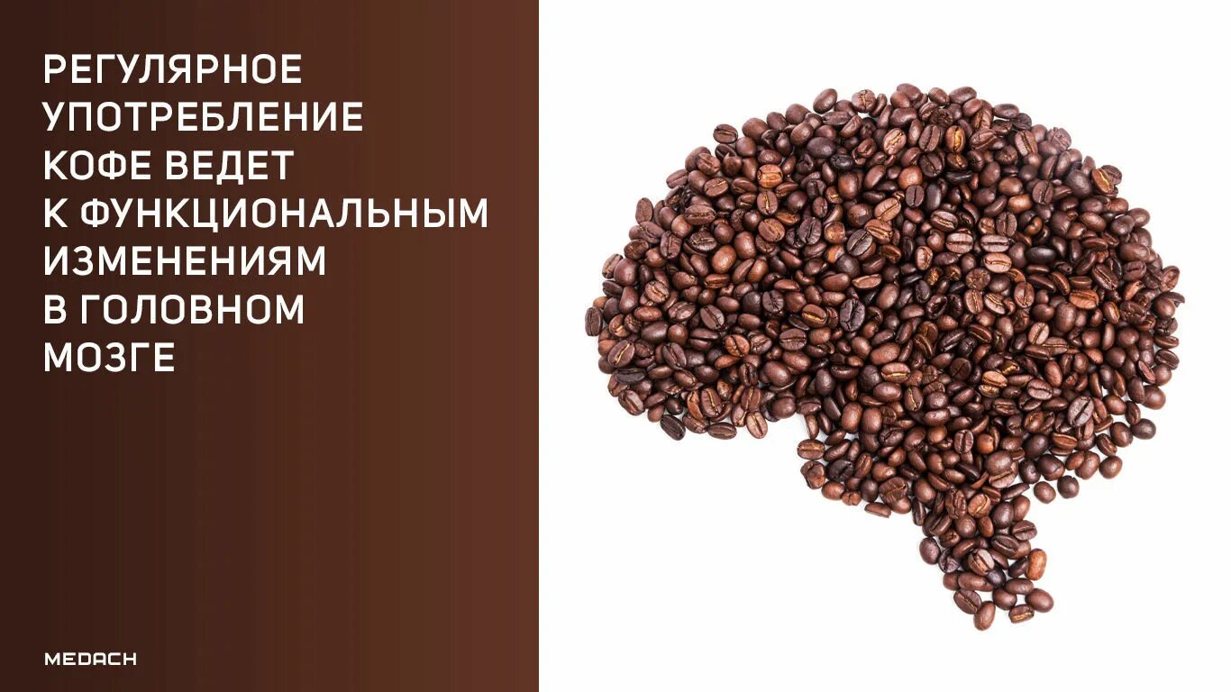 Как кофе влияет на мозг. Кофе и мозг. рекомендации по употреблению кофе. кофе психология. памятка по употреблению кофе.