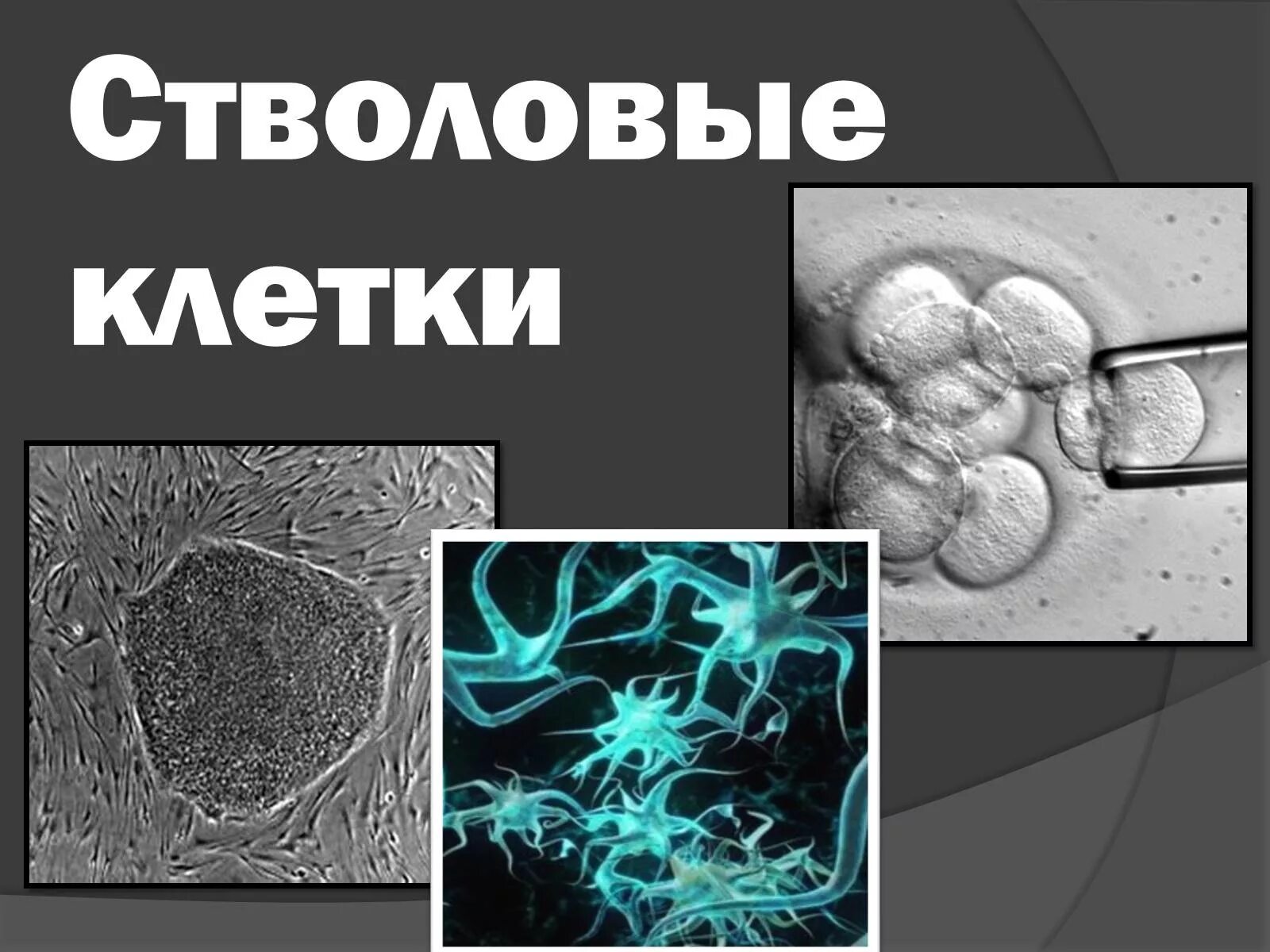 1 стволовые клетки. Стволовые клетки. Стволовые клетки презентация. Стромальные клетки. Фетальные стволовые клетки.