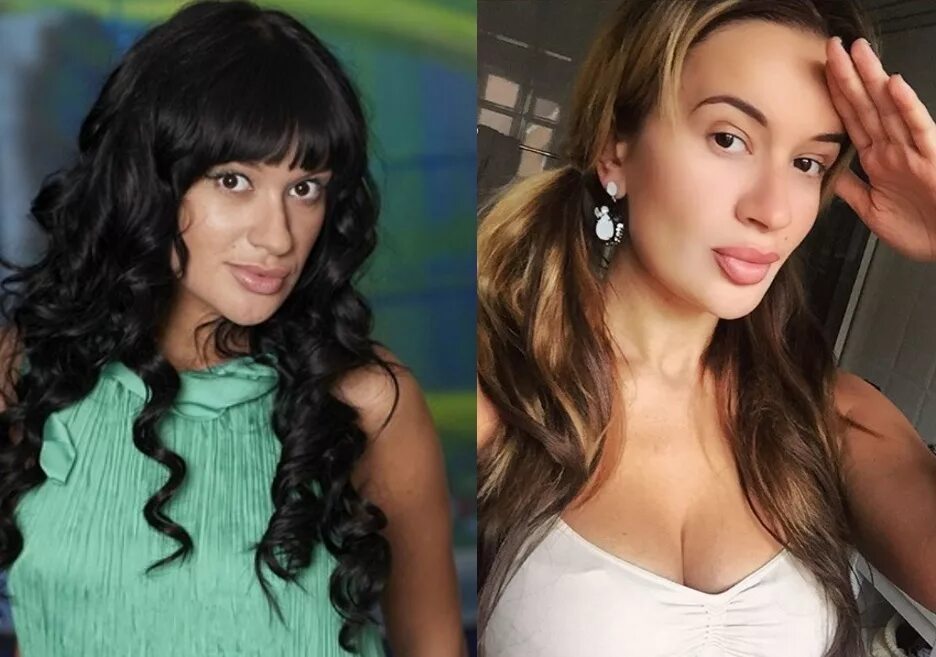 Бушина до пластики фото и после - SadPhoto.ru