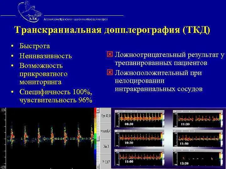 Транскраниальное ультразвуковое сканирование головного мозга. Транскраниальное сканирование сосудов головного мозга показатели. Транскраниальная ультразвуковая допплерография. Ультразвуковая допплерография транскраниальная артерий и вен (ТКДГ). Транскраниальных артерий и вен